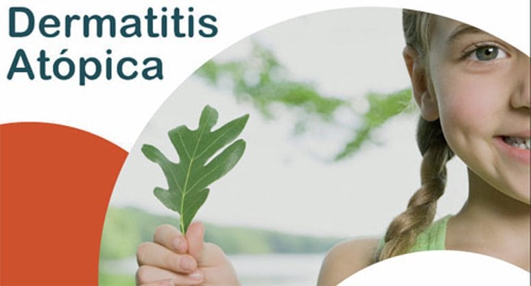 Aproximadamente un 10% de la población general tiene dermatitis atópica